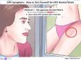 HPV Symptoms - How to Test Yourself for HPV Genital Warts PowerPoint PPT Presentation