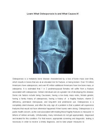 Learn What Osteoporosis Is and What Causes It!