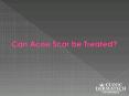 Can Acne scar be treated? - Clinic Dermatech PowerPoint PPT Presentation