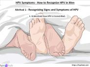 HPV Symptoms - How to Recognize HPV in Men