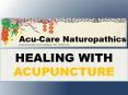 How Acupuncture Aids Overall Health? PowerPoint PPT Presentation