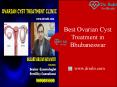 Ovarian Cyst Treatment (1) PowerPoint PPT Presentation