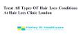Treat All Types OF Hair Loss Conditions At Hair Loss Clinic London PowerPoint PPT Presentation