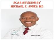 SCAR & KELOID TREATMENT