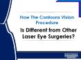 How The Contoura Vision lasik surgery Procedure Is Different from Other Laser Eye Surgeries? PowerPoint PPT Presentation