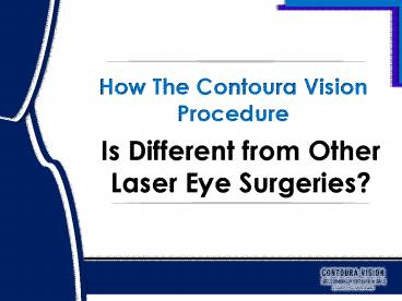 How The Contoura Vision lasik surgery Procedure Is Different from Other ...