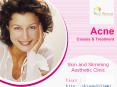 Acne Skin Treatments Around Sandton PowerPoint PPT Presentation