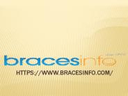 Invisalign Braces Reviews