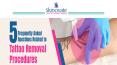 5 FREQUENTLY ASKED QUESTIONS RELATED TO TATTOO REMOVAL PROCEDURES PowerPoint PPT Presentation
