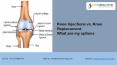 Knee Injections vs. Knee Replacement: What Are My Options - Dr Chirag Patel PowerPoint PPT Presentation