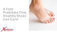 4 foot problems that healthy shoes can cure PowerPoint PPT Presentation