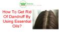 Essential Oils for Hair Dandruff PowerPoint PPT Presentation