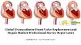 Global transcatheter heart valve replacement and repair market professional survey report 2019 PowerPoint PPT Presentation