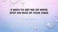 9 Ways to Get Rid of White Spot on Face of Your Child - Wonder Parenting PowerPoint PPT Presentation