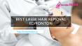 Best Laser Hair Removal Edmonton PowerPoint PPT Presentation