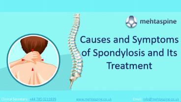 Causes and Symptoms of Spondylosis and Its Treatment | MehtaSpine UK