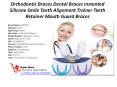 Orthodontic Braces Dental Braces Instanted Silicone Smile Teeth Alignment Trainer Teeth Retainer Mouth Guard Braces PowerPoint PPT Presentation