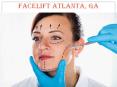 Facelift Atlanta, GA | Buckhead Face Lift PowerPoint PPT Presentation