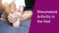 Rheumatoid Arthritis in the Feet- What to Know? PowerPoint PPT Presentation
