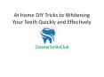 At Home DIY Tricks to Whitening Your Teeth Quickly and Effectively PowerPoint PPT Presentation