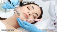 Vampire Facial Los Angeles