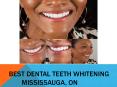 BEST DENTAL TEETH WHITENING MISSISSAUGA, ON PowerPoint PPT Presentation
