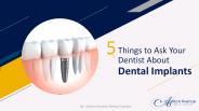 5 Things to Ask Your Dentist About Dental Implants