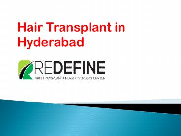 Hair Transplant in Hyderabad | Hair Transplantation Cost Hyderabad