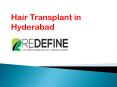 Hair Transplant in Hyderabad | Hair Transplantation Cost Hyderabad PowerPoint PPT Presentation