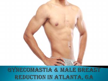 Gynecomastia Atlanta, GA | Buckhead Gynecomastia Surgery