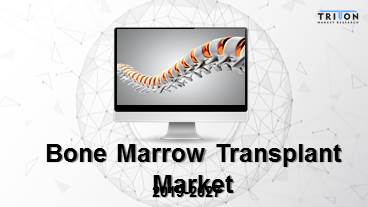 Global Bone Marrow Transplant Market Trends, Forecast 2019-2027