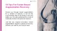 10 Tips For Faster Breast Augmentation Recovery PowerPoint PPT Presentation