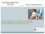 Scalp Micropigmentation