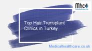 Top Hair Transplant Clinics in Turkey