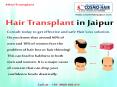 Are you worry about hair loss or hair fall. PowerPoint PPT Presentation