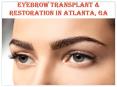 Eyebrow Transplant Atlanta, GA | Buckhead Eyebrow Transplant PowerPoint PPT Presentation