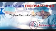 Critical Limb Ischemia