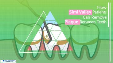 How Simi Valley Patients Can Remove Plaque between Teeth