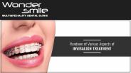 Rundown of Various Aspects of Invisalign Treatment