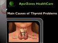 Main Causes of Thyroid Problems PowerPoint PPT Presentation