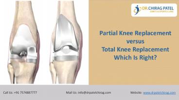 Partial Knee Replacement versus Total Knee Replacement: Which Is Right? | Dr Chirag Patel