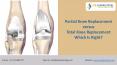 Partial Knee Replacement versus Total Knee Replacement: Which Is Right? | Dr Chirag Patel PowerPoint PPT Presentation