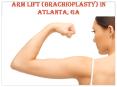 Arm Lift Atlanta, GA | Buckhead Arm Lift (Brachioplasty) PowerPoint PPT Presentation