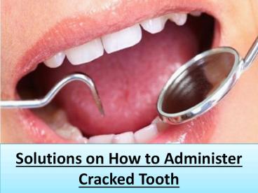 Solutions on How to Administer Cracked Tooth