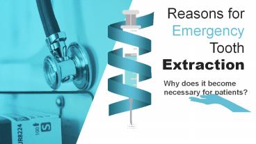 Dentist Reasons for Emergency Tooth Extraction