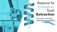 Dentist Reasons for Emergency Tooth Extraction
