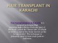 Hair transplant in Karachi PowerPoint PPT Presentation