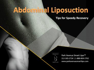 Abdominal Liposuction - Tips for Speedy Recovery