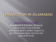 Liposuction in Islamabad (1)