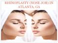 RHINOPLASTY (NOSE JOB) IN ATLANTA, GA PowerPoint PPT Presentation